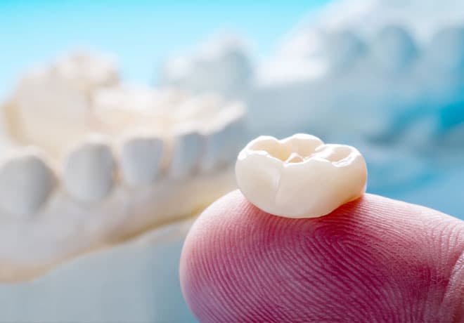 Dental Crowns in Temple, TX