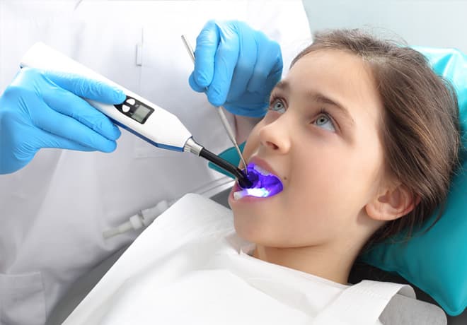 Dental Sealants in Temple, TX