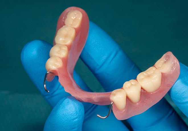 Dentures in Temple, TX